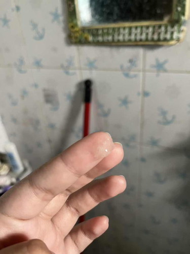 แบบนี้คือมูกใสใช่ไหมคะ