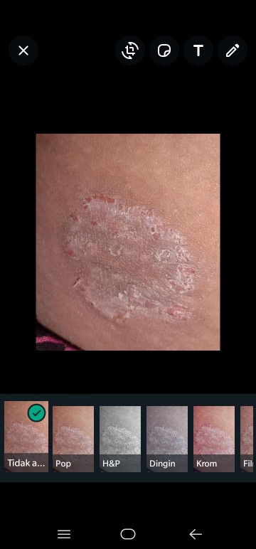 Gatel semenjak hamil