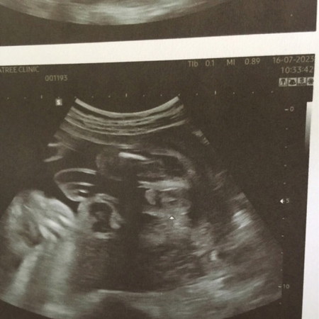 ลูกชายกี่เปอร์เซ็น