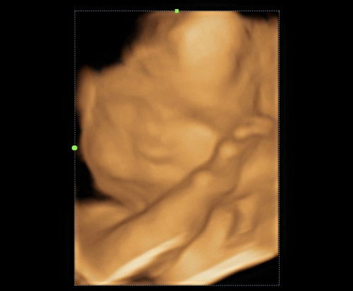 3D/4D Recommendations