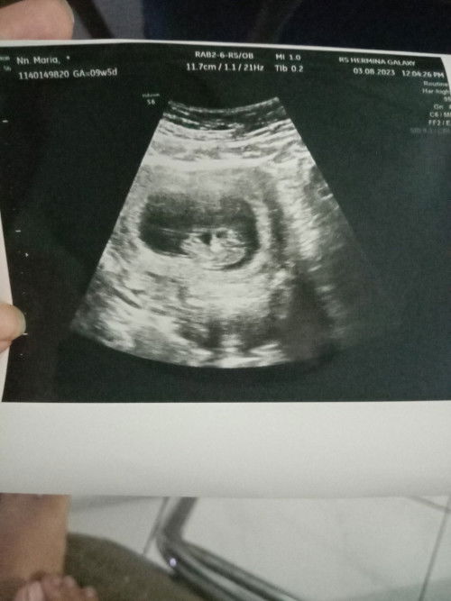 Puji Tuhan,baby-nya sesuai dengan hpht aku haid