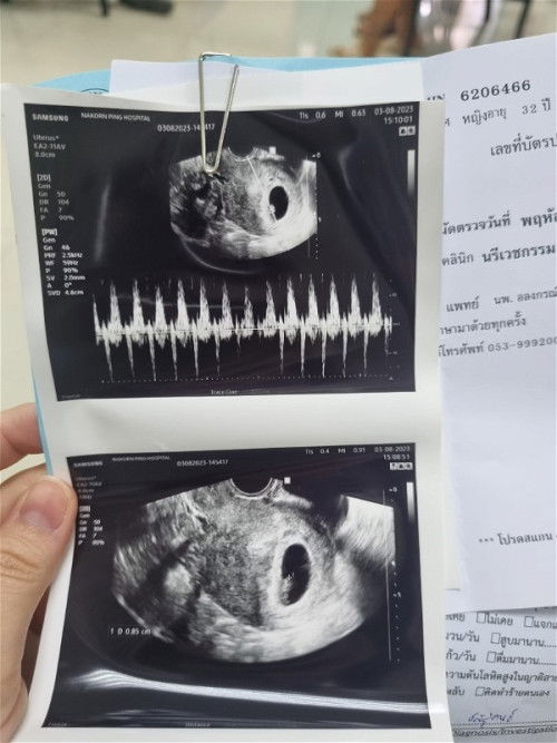 ท้องแรก 7w 🤰👼