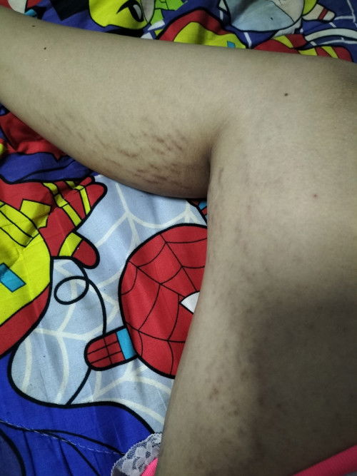 อยากสอบถามเรื่องการแตกลายค่ะ