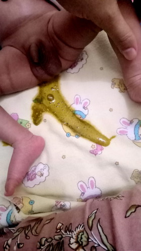 Bayi 19 hari bab nya mencret knpa ya .?.takut bgt