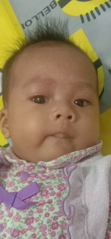 หน้าลูกตรงคิวเป็นด่างขาวเป็นกากน้ำนมใช้ใหม่ค่ะ