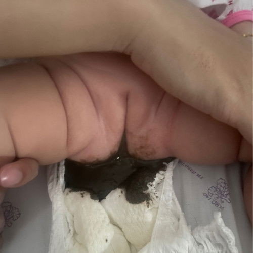 อาการแบบนี้เรียกว่ายังไงคะ