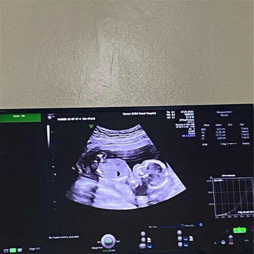 แขร์รูปอัลตราซาวด์กันค่ะ