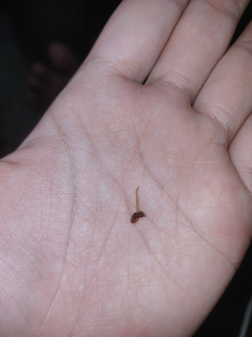 Pasca operasi SC eracs