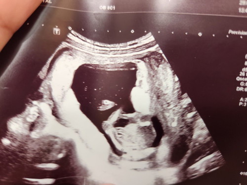 ลูกคนแรก ท้องแรก