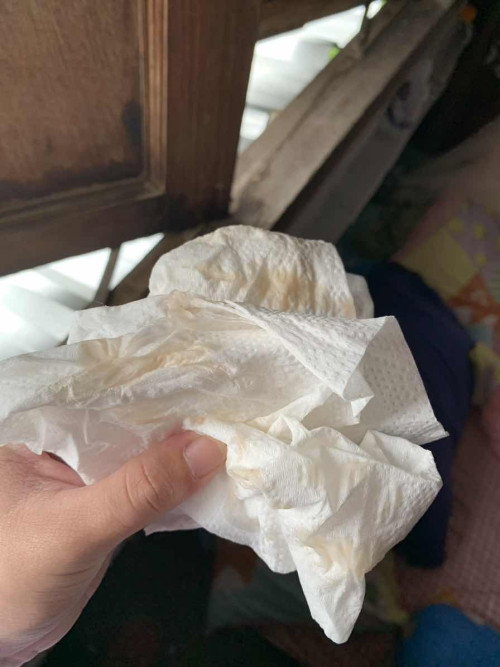 แบบนี้อันตรายมั้ยคะ ต้องไปหาคุณหมอมั้ยคะแม่ๆ?