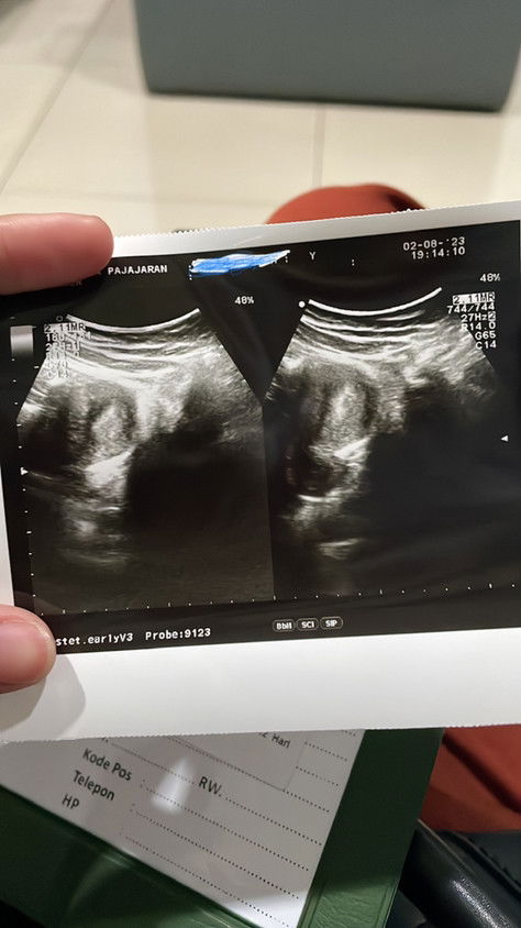 Apa yg harus dilakukan jd ibu pertama kalinya?