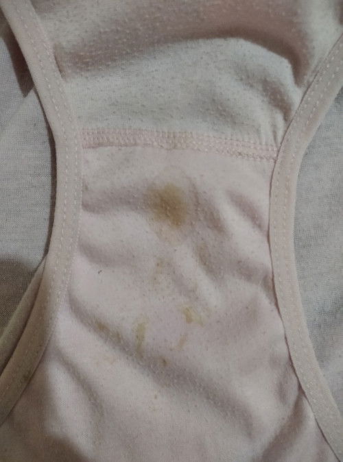 Flek atau keputihan ya bund?