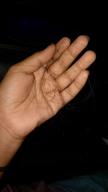 ขอวิธีแก้ผมร่วงแม่ๆค่ะ