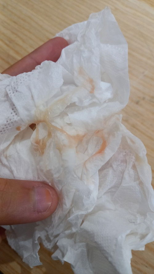 Harini ttba keluar spoting tp warna pink muda knpa ya 😥😥😢