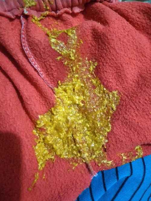 Phân nhầy
Tế nhị một xíu, xin lỗi các mom nhá