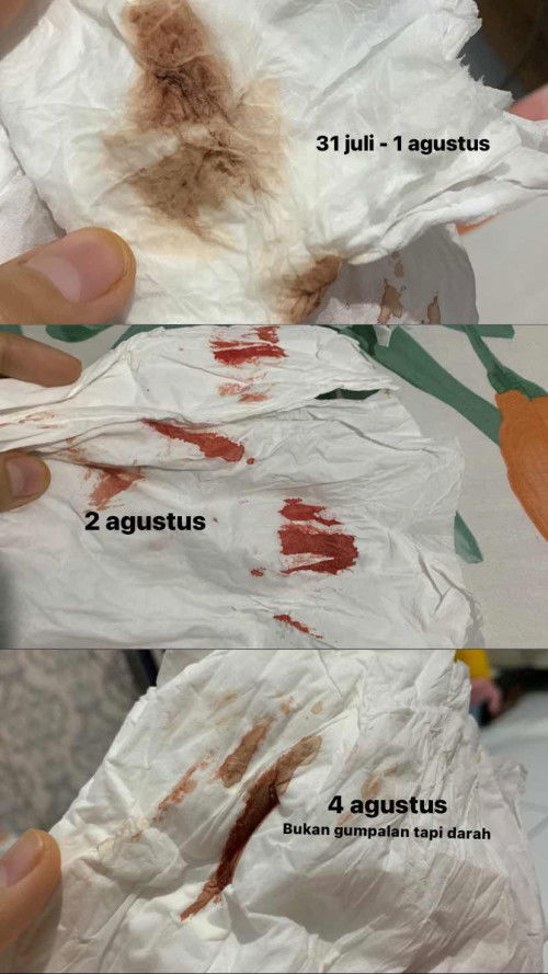 Flek coklat sampai darah