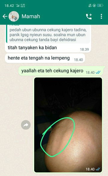 ubun ubun cekung