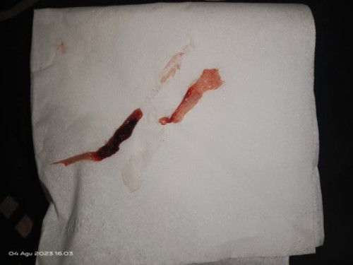 Mau tanya ini ini darah haid atau keguguran yaa..?