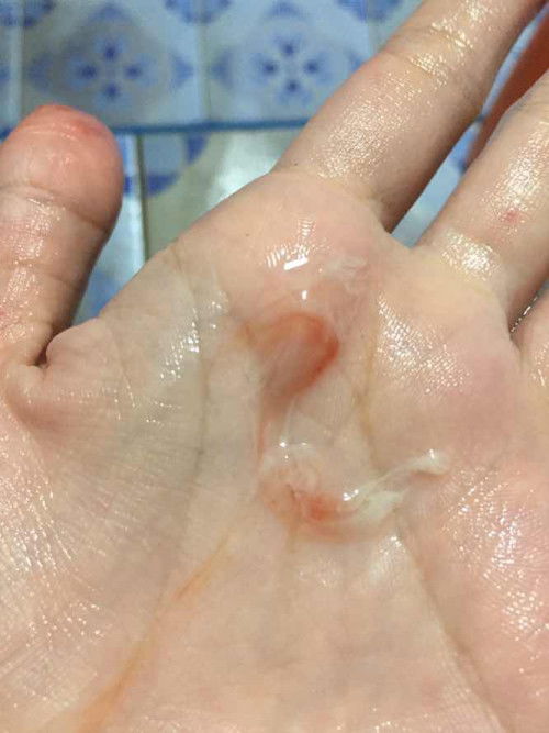 สอบถามแม่ๆ ช่วยด้วยนะคะ