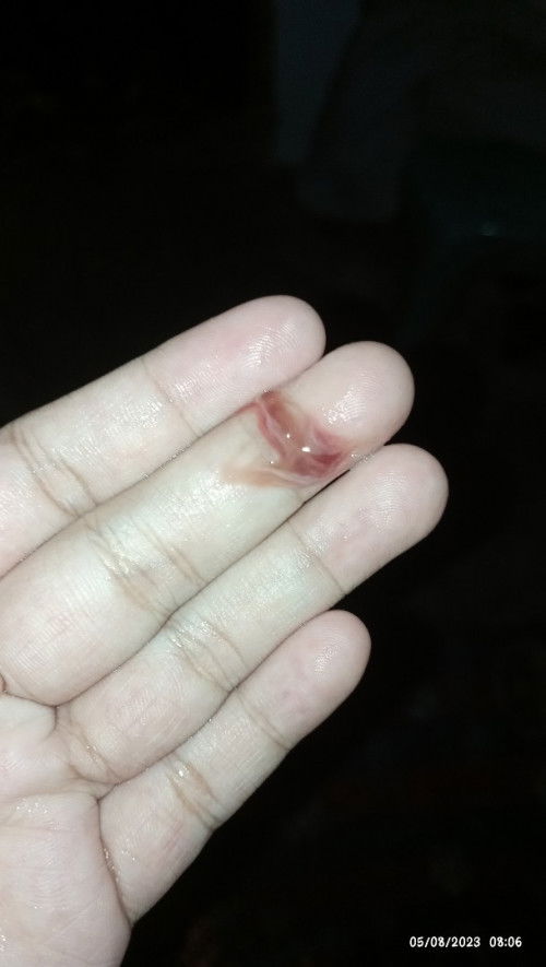 Keluar keputihan coklat saat hamil 38w4d