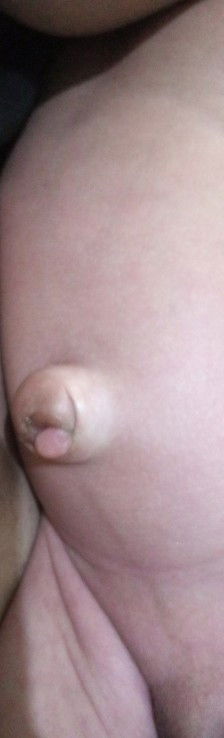 Muncul seperti daging di pusar nb