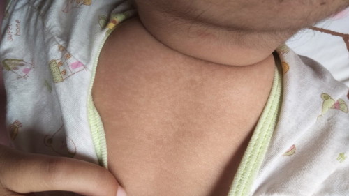 ลูกมีด่างขาว เป็นดวงๆ