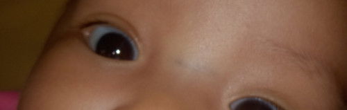 Urat bayi di sekitar mata