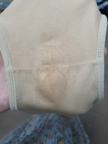 อายุครรภ์ 21 สัปดาห์ มีเลือดจางติดกกน. เป็นครั้งเเรก ไม่ปวดท้องน้อย