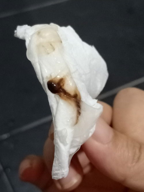 LENDIR & DARAH COKLAT MASA OVULASI BAHAYA ATAU TDK??