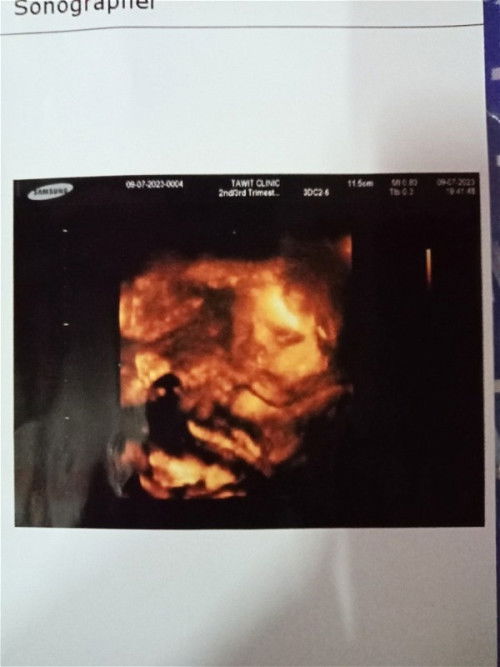 #ทีมกันยายน