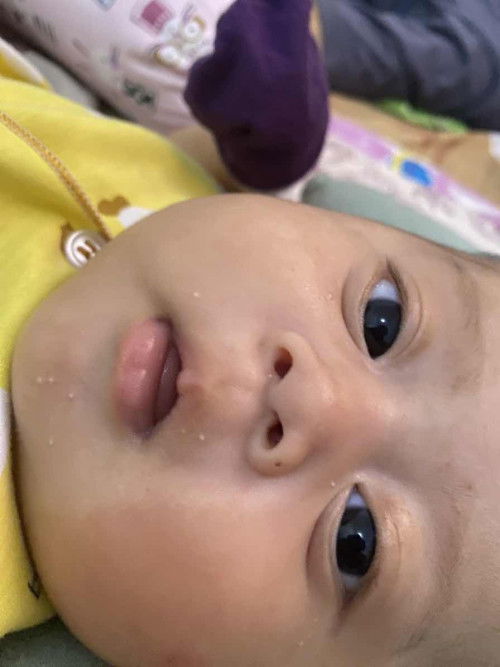 Bintik putih di wajah