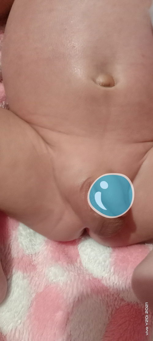 normal ba sumakit ang pusun .pgktpos maglagay ng primrose sa pempem?