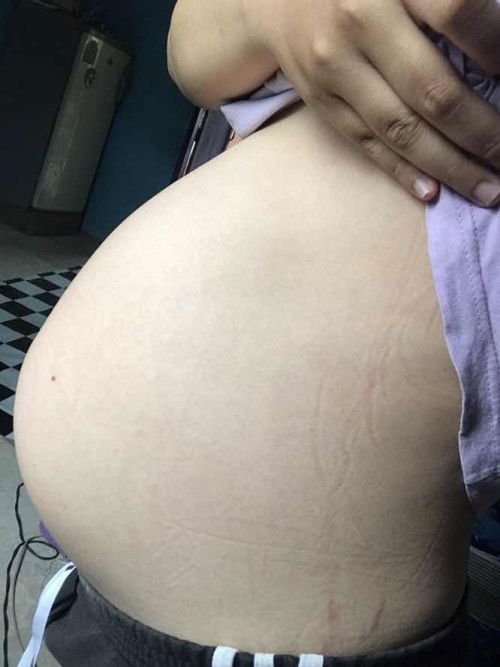 รู้สึกท้องเล็กลงจากเดิม แบบนี้ท้องลดไหมคะ