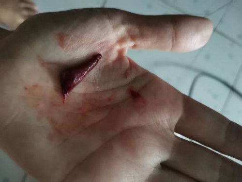 แบบนี้แท้งไหมค่ะ​