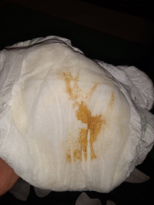 Ada bercak kecoklatan di popok