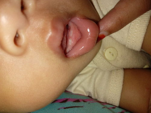 Keluar gigi nya lama