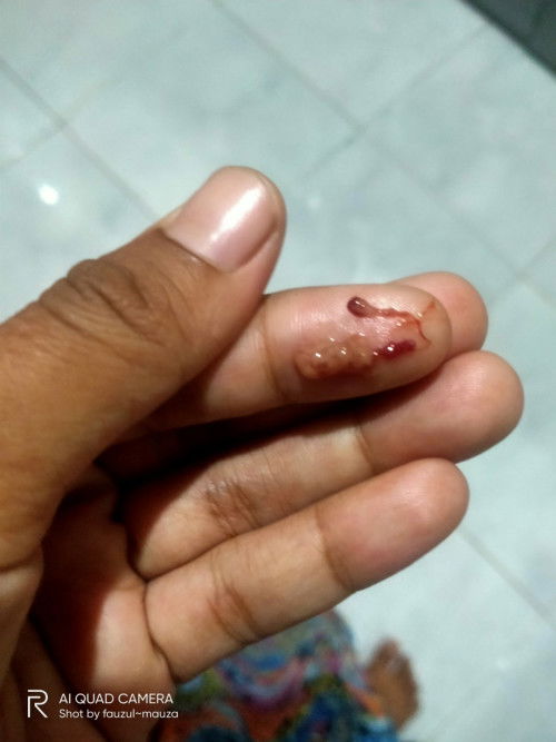 UrinBunda ..mau tanya..ad yg sma gag...gag tau knapa..bangun pagi kblet pipis...stelah itu terus mne