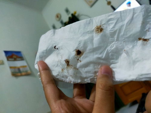 Seperti ini jgn di abaikan yah ! 
(Sekedar berbagi cerita aja bunda)