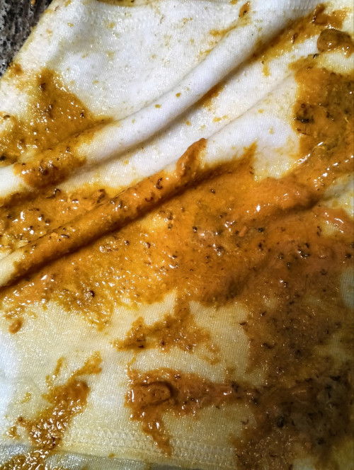 Bab bayi ada serat hitam