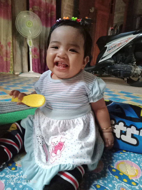 Gigi bayi umur 9bulan