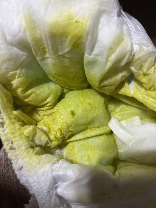 Green na poop ni baby