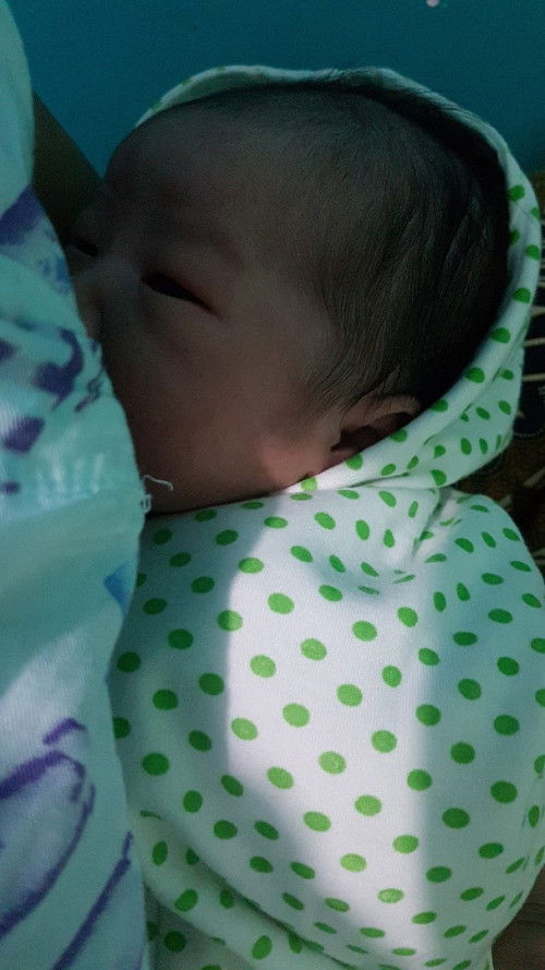 Lahiran normal plus jahitan