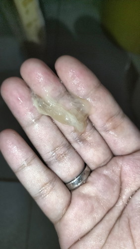 Ano po itong lumabas sa kin madami po parang sipon?? 38weeksand5days na po ako..