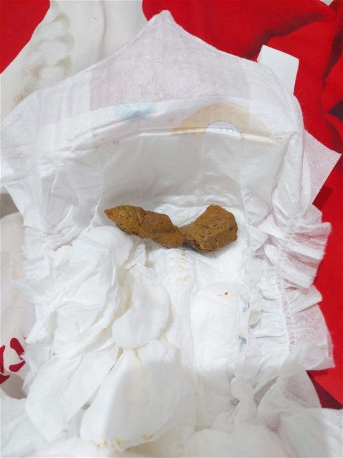 Bayi 6 bulan sering sembelit