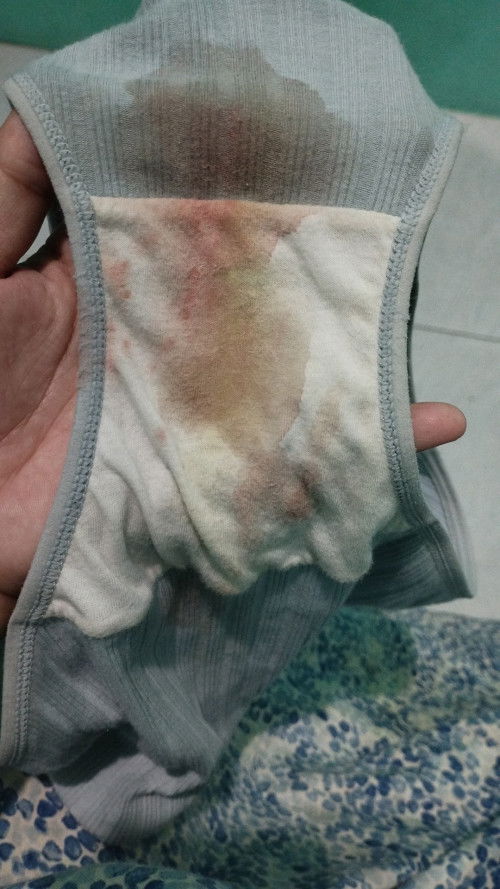 Keluar darah seperti mens