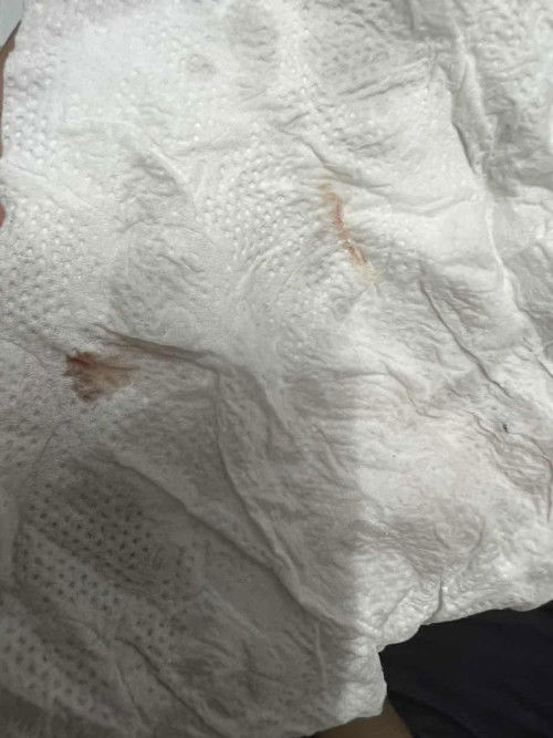 มีเลือดซึมออกมาหลังอาบน้ำ