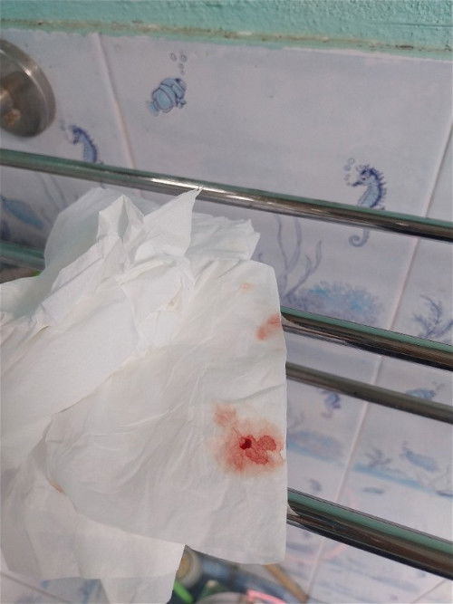 สอบถามแม่ๆหน่อยค้าา