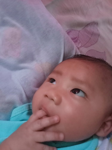 2months old normal ba ito?
