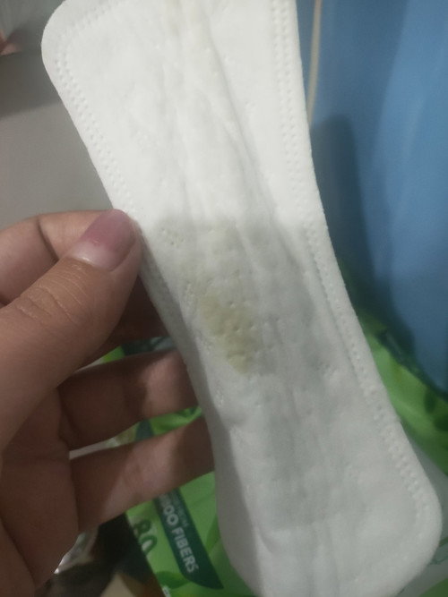 Green/yellow discharge sa panty liner