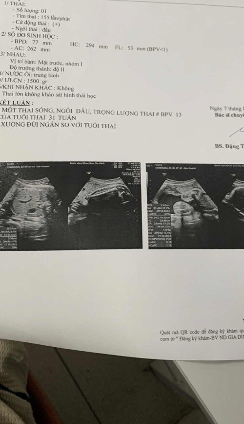 31 tuần e bé được 1kg5 có nhỏ quá ko các mom